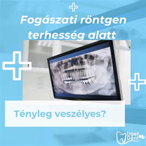 időzített fogászati kezelések terhesség alatt
