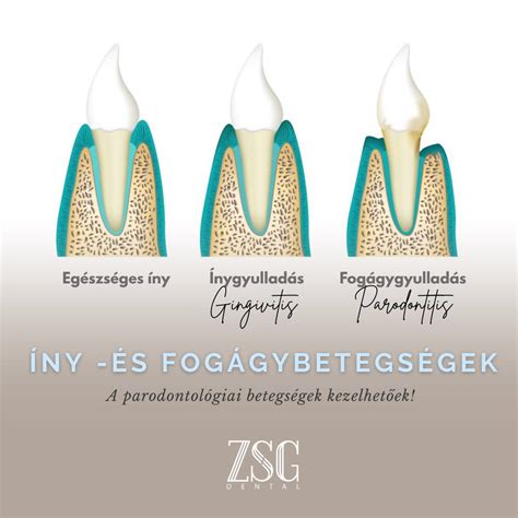 egészséges fogak és íny