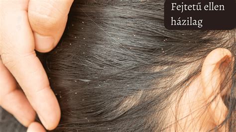 infografika a fejtetű elleni kezelés lépéseiről