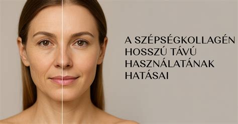 Bőr-bőr kontaktus előnyei