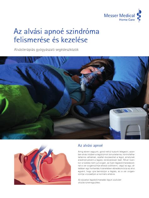 alvási minták és koraszülés