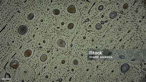 toxoplazma parazita mikroszkóp alatt