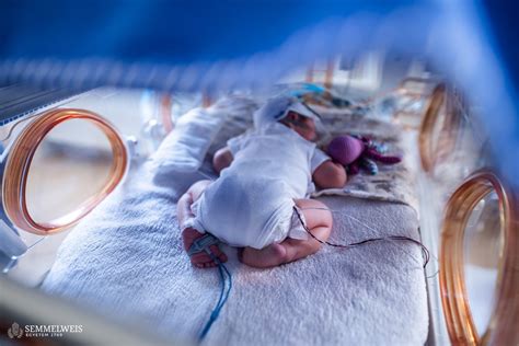 Egy újszülött intenzív osztályon