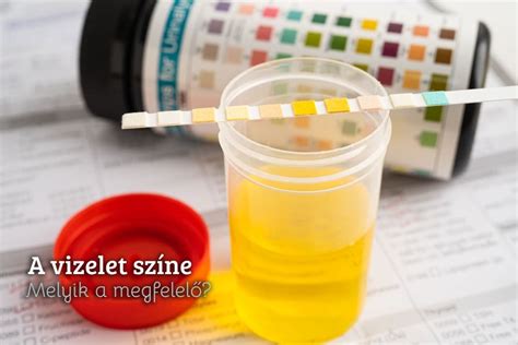 A vizelet színének kapcsolata a hidratáltsággal